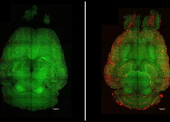 Bilim İnsanları Nano-parçacık Tedavisiyle Alzheimer’ı Tersine Çevirmeyi Başardı