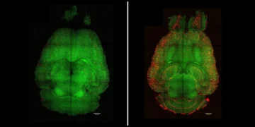 Bilim İnsanları Nano-parçacık Tedavisiyle Alzheimer’ı Tersine Çevirmeyi Başardı