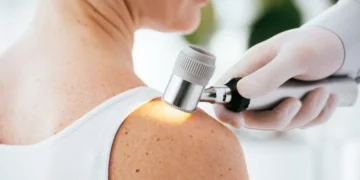 Dermatoloji Nedir? Dermatologlar Hangi Hastalıklara Bakar?