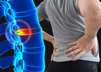 Bel Fıtığı Nedir? Belirtileri, Tanısı ve Güncel Tedavi Yöntemleri